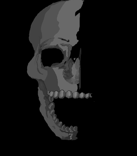 skeleton